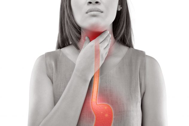 Woman Suffering From Acid Reflux Or Heartburn-Isolated On White Background