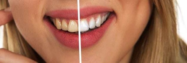 teeth-gfbe6f3ff4_640