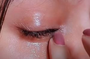 Nainen keksi nerokkaan tavan poistaa tummat silmänaluset pysyvästi – tärkein ainesosa löytyy keittiöstä Capture